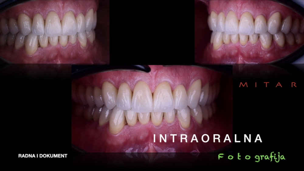 Dentalna fotografija 028